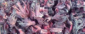 The University College Hospital (UCH)